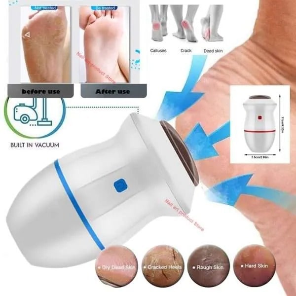 ELECTRIC VACUUM  FOOT CALLUS AND DEAD SKIN  REMOVER | Imported