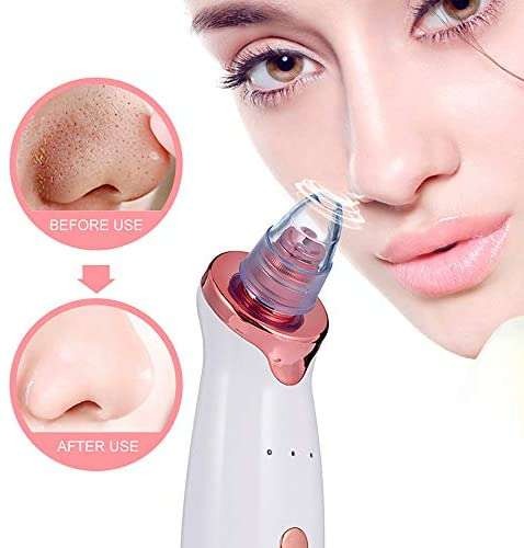 Electric Facial Cleansing Device Vacuum Pore Cleaner For Acne Blackhead Whitehead and Pimples